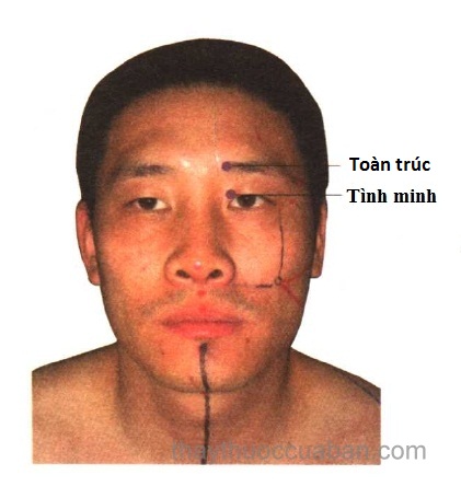 Vị trí huyệt tình minh