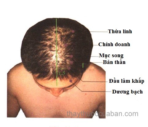 Vị trí huyệt thừa linh
