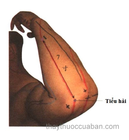 Cách xác định huyệt tiểu hải