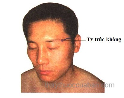 Vị trí huyệt tý trúc không