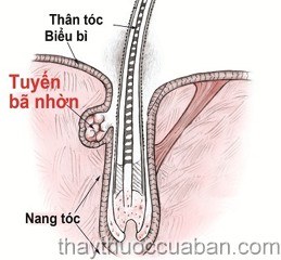 Rụng tóc tiết bã nhờn