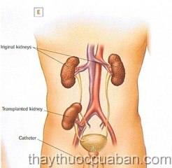 Đông y chữa sa thận