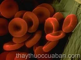 Tăng hồng cầu vô căn