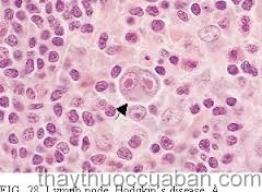 Tăng sinh mô ác tính