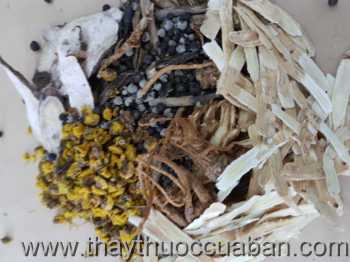 Đông y chữa bệnh sỏi thận