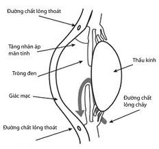 Đ&ocirc;ng y chữa bệnh glocom