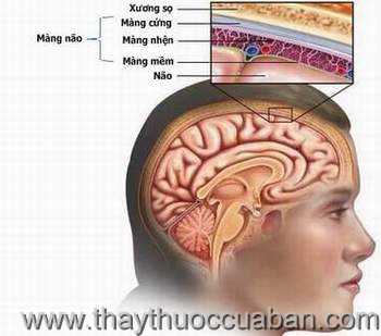 Bệnh lao màng não