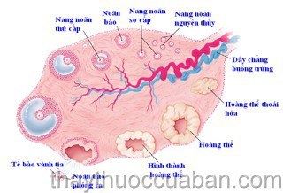 Rối loạn phóng loãn